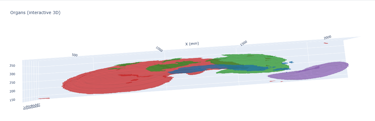 Swin UNETR — BTCV Multi-Organ 3D Segmentation (Pretrained + Custom Upgrades) gallery image 3