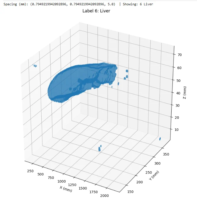 Swin UNETR — BTCV Multi-Organ 3D Segmentation (Pretrained + Custom Upgrades) gallery image 1